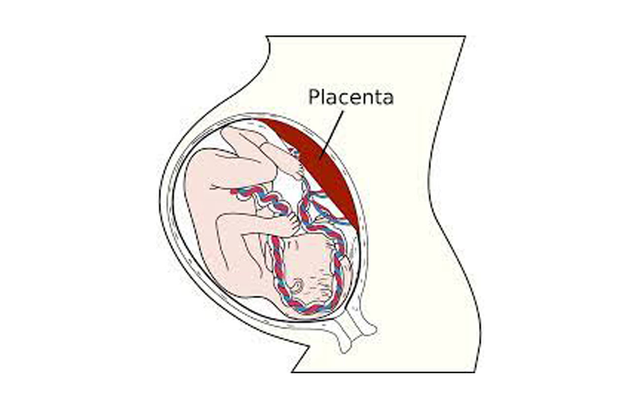 Depression in pregnancy and placental changes